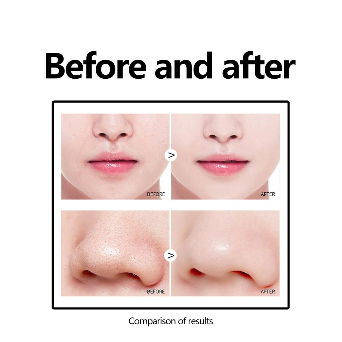 West&Month Blackhead Removal Peeling Mask Deep Cleansing Facial Mask For Blackhead Acne Pore Refining Skin Care 60ml