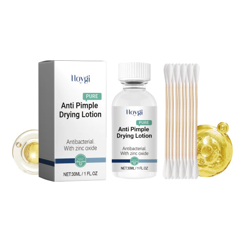 Hoygi Anti-Pimple Drying Lotion, Facial Cleansing And Repair Lighten Acne Marks And Pits, Close Your Mouth And Mild Skin Cream