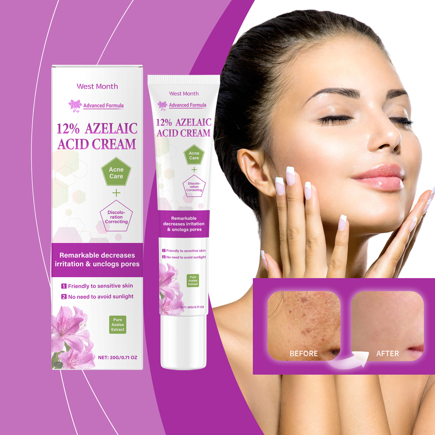 West&Month Azelaic Acid Cream Daily Acne Gentle Cleansing And Repair Skin Smooth And Moisturizing Cream