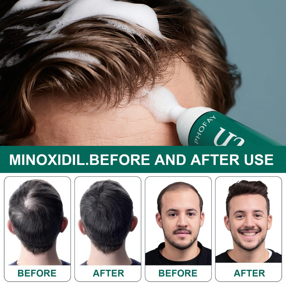CH004 Minoxidil Anti-Hair Loss Mousse