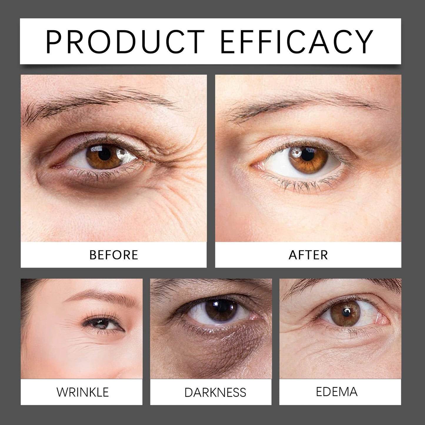 OUHOE Micro-Minerals Eye Fat Diminishing Cream, Eye To Butter Cream Moisturizing Anti-Wrinkle Bust Firming Moisturizing Eye Creams