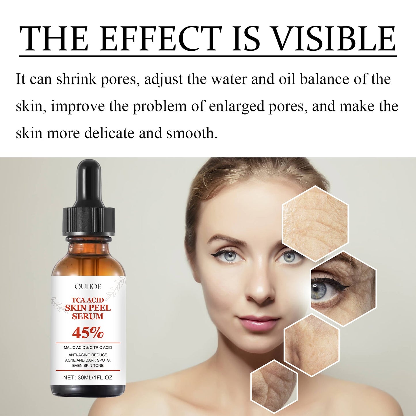 OUHOE TCA Acid Skin Peel Serum
