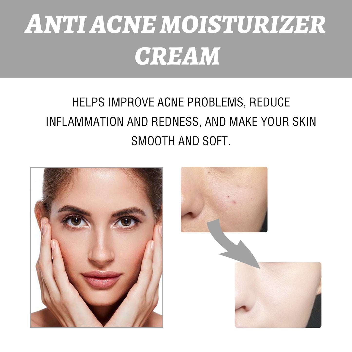 Eelhoe Hydrating Cream Hydrating And Lightening Facial Acne Repair Redness Hydrating And Brightening Moisturizing Cream