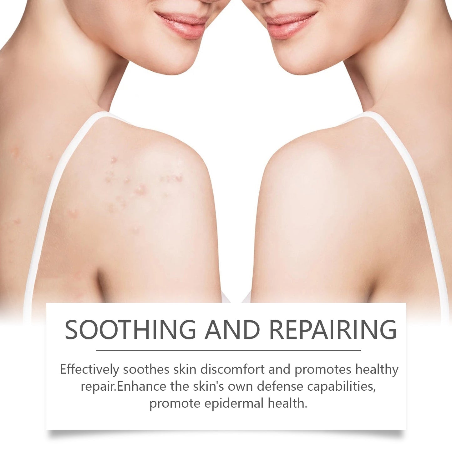 Hoygi Centella Asiatica Skin Cream, With Its Gentle Plant Ingredients, Nourishes The Skin And Gives It A Radiant Glow