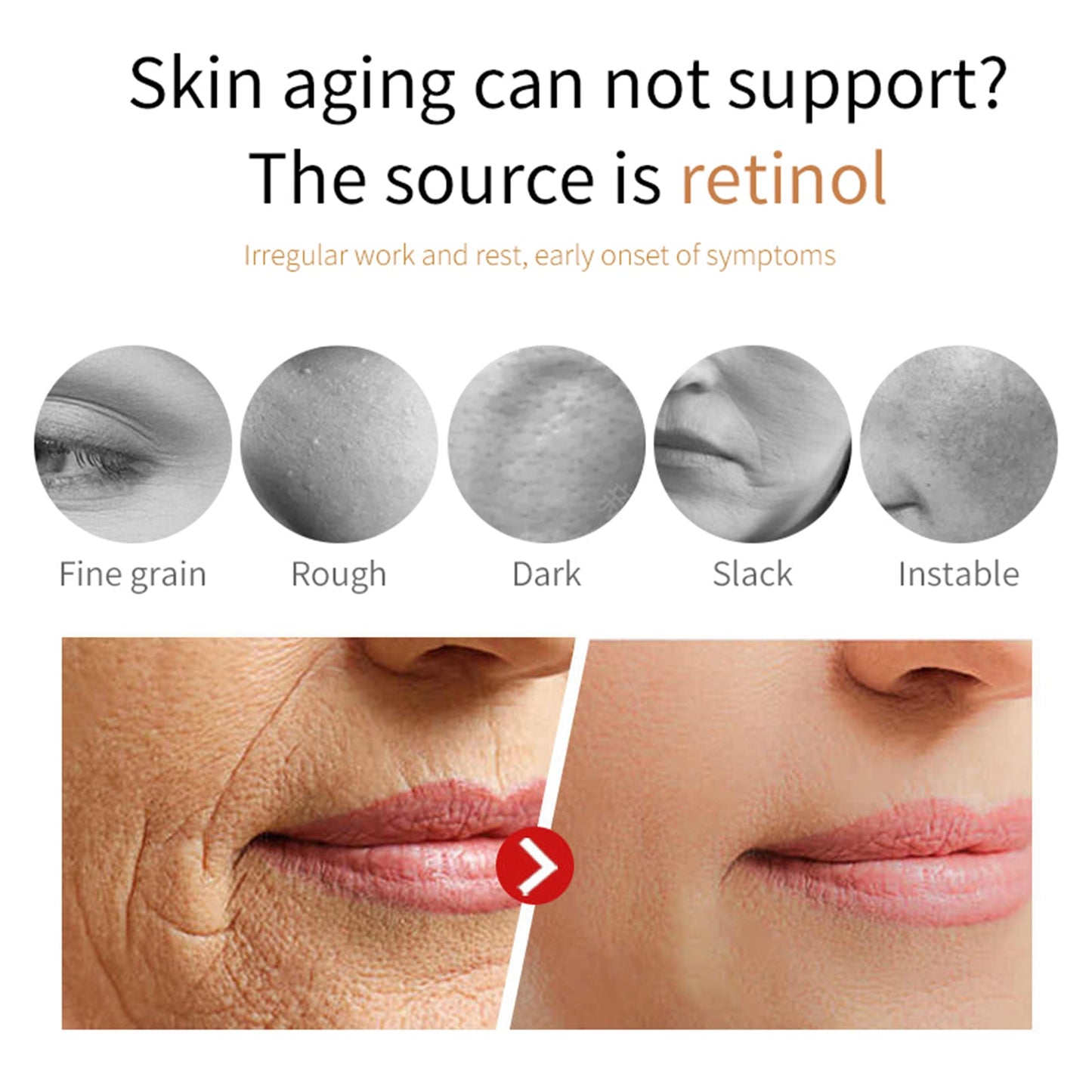 Hoygi Retinol Face Cream, Firming Smooth Skin To Fade Out Fine Lines Dry Tyra Facial Contour Lines