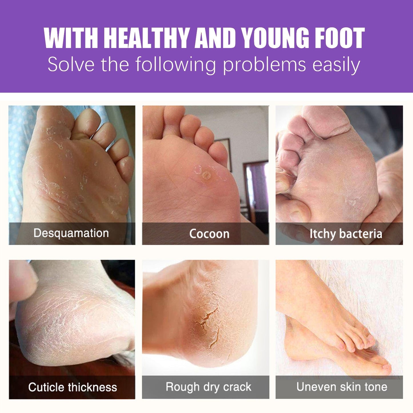 EELHOE Ginger Foot Mask (Bag) Foot Moisturizing, Nourishing, Rejuvenating, Exfoliating, Removing Dead Skin, Dry And Cracked Skin Care Foot Mask