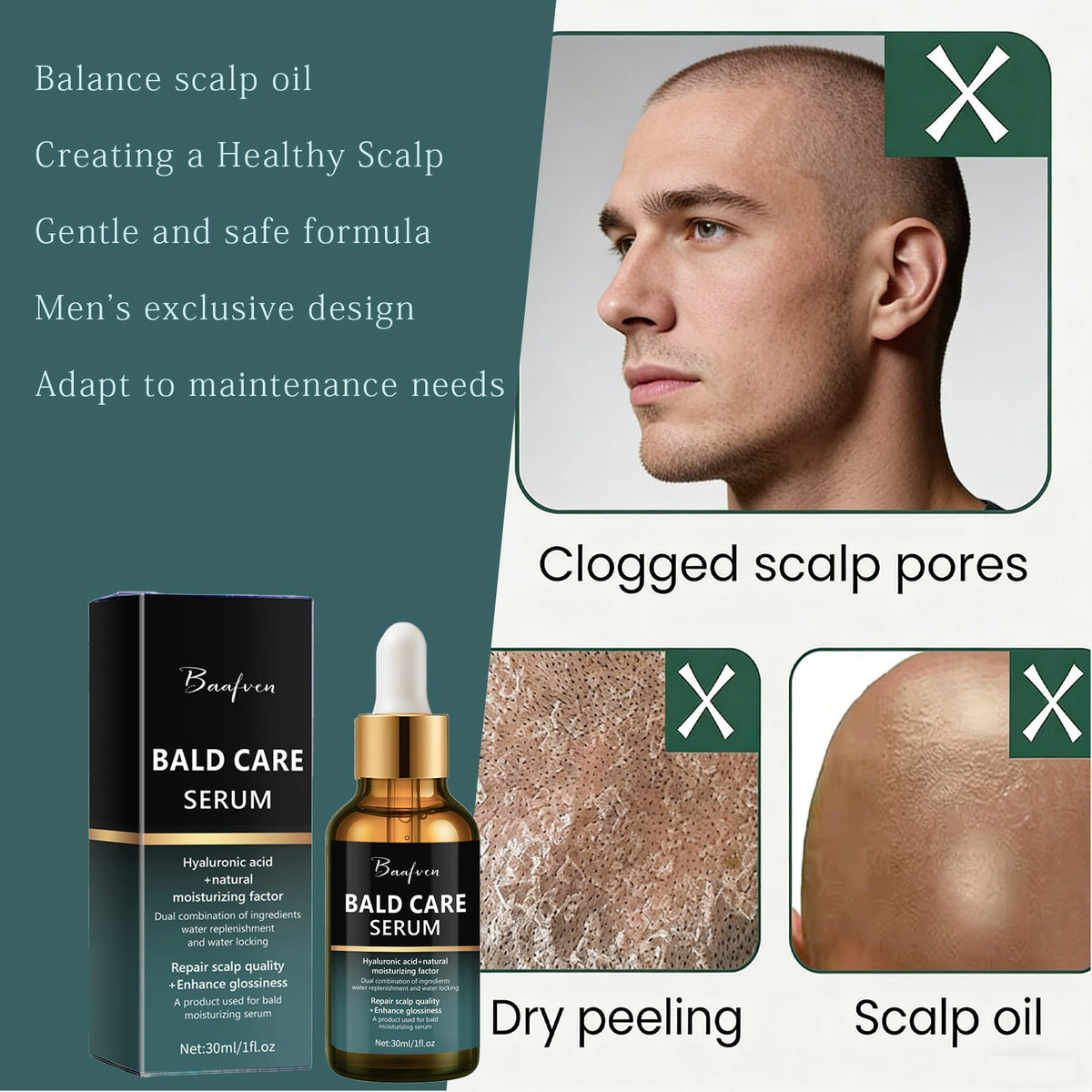 Cross-Border New Model Scalp Care Essence For Men, Moisturizing And Nourishing For Bald Heads And Shaving Skin, 30ml