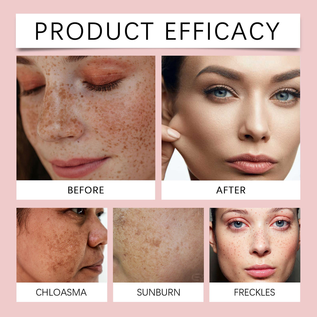OUHOE Freckle Whitening Brightening Serum, Brightening And Firming Skin Plant Extract