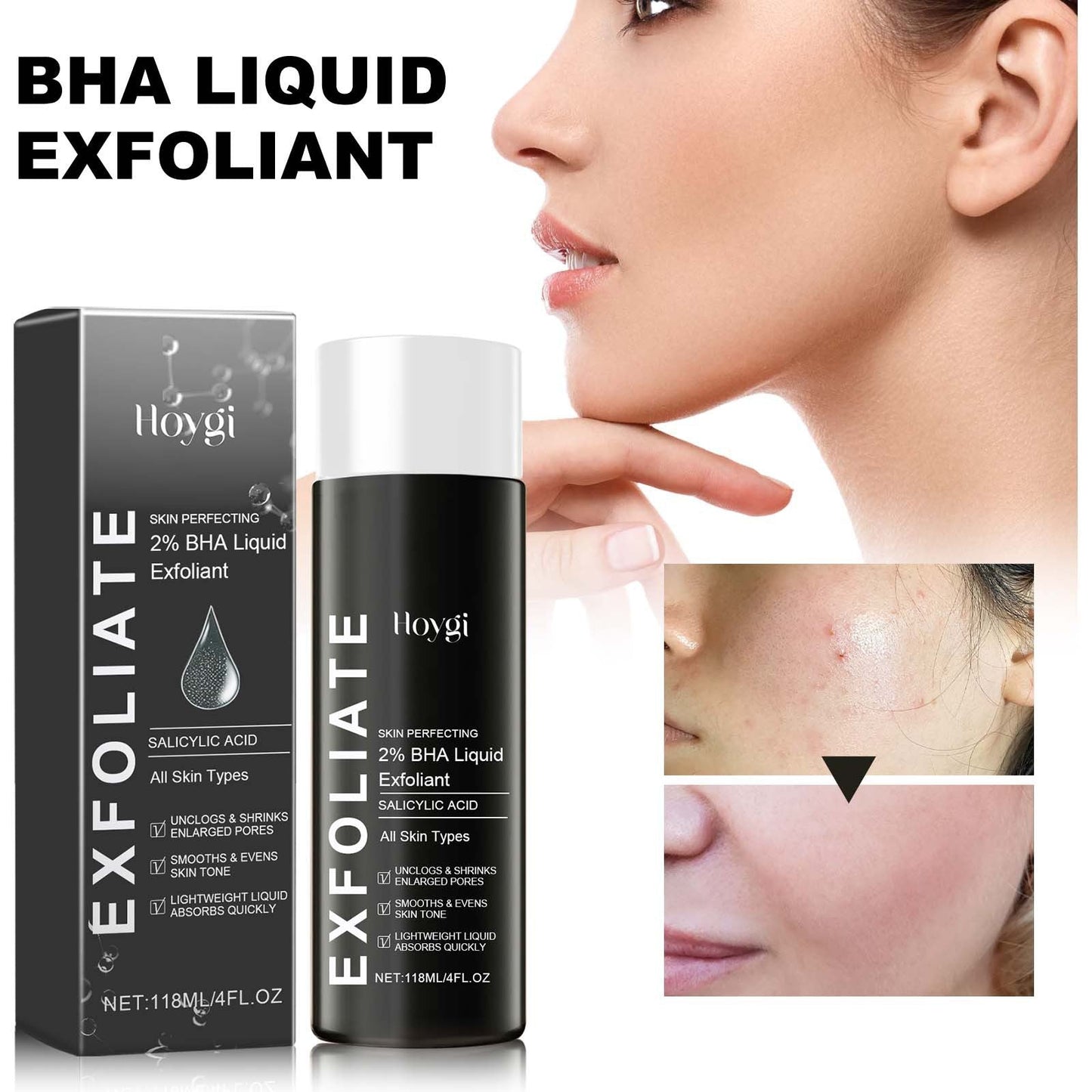Hoygi BHA Liquid Exfoliant, Lightening Acne Seal Pore-Tightening And Moisturizing Skin Essence