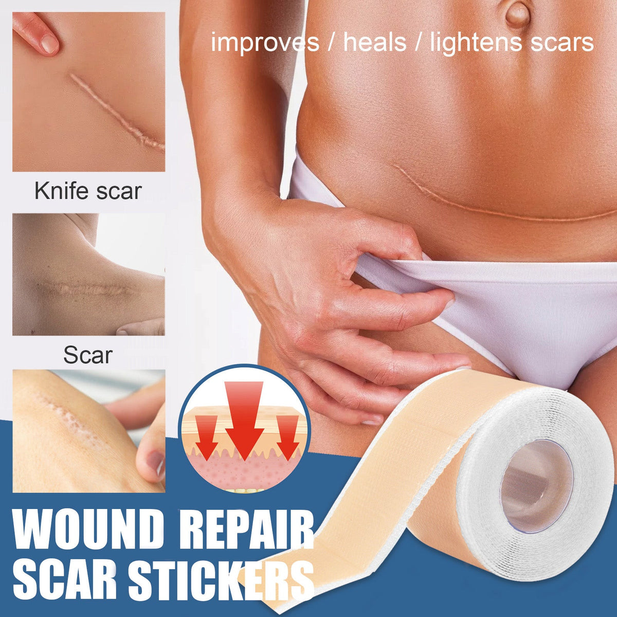 Diminish Blemishes With Daily Skin Repair Patches