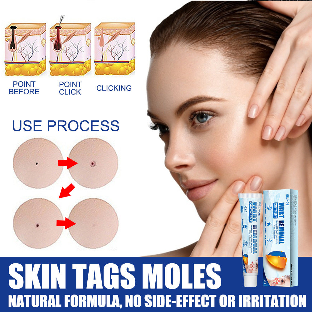Hand And Foot Facial Armpit Flat Monkey Youke Wart Cream