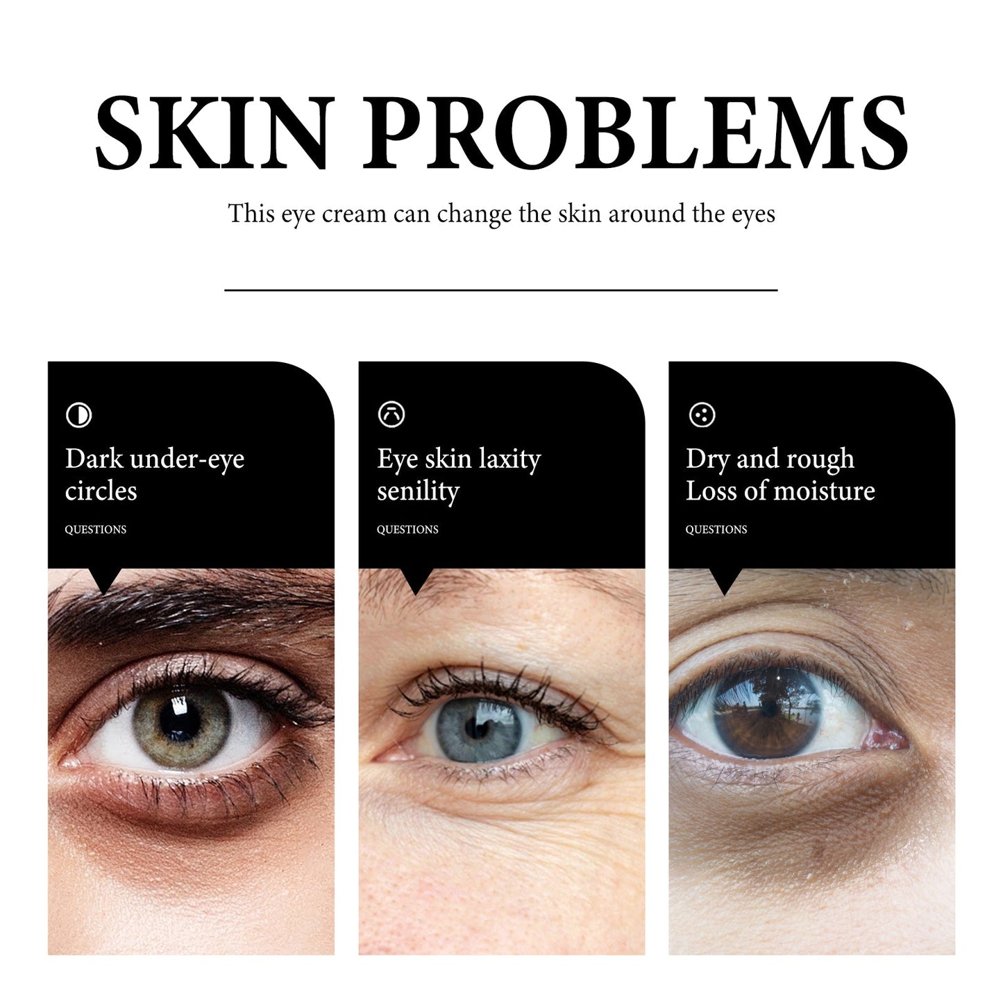 Wiyun Eye Cream: Gentle And Nourishing Care For The Skin Around The Eyes, Soft And Tender Skin Care, Hydrating Skin Care Eye Cream