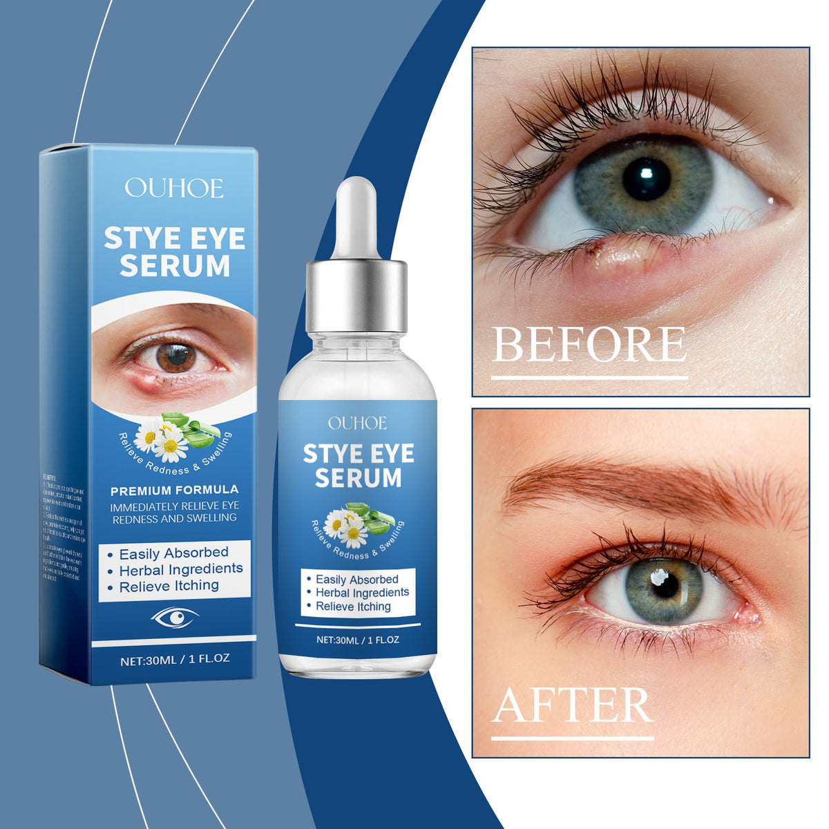 OUHOE Eye Care Drops Gently Nourish And Moisturize The Skin Around The Eyes. Portable Daily Eye Care Drops