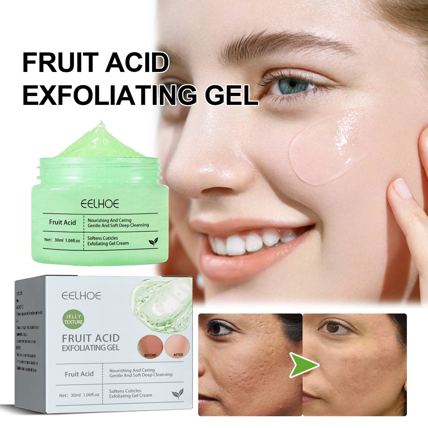 EELHOE Acid Facial Exfoliating Gel Deep Clear Pores Blackheads Acne Whitening Skin Gel