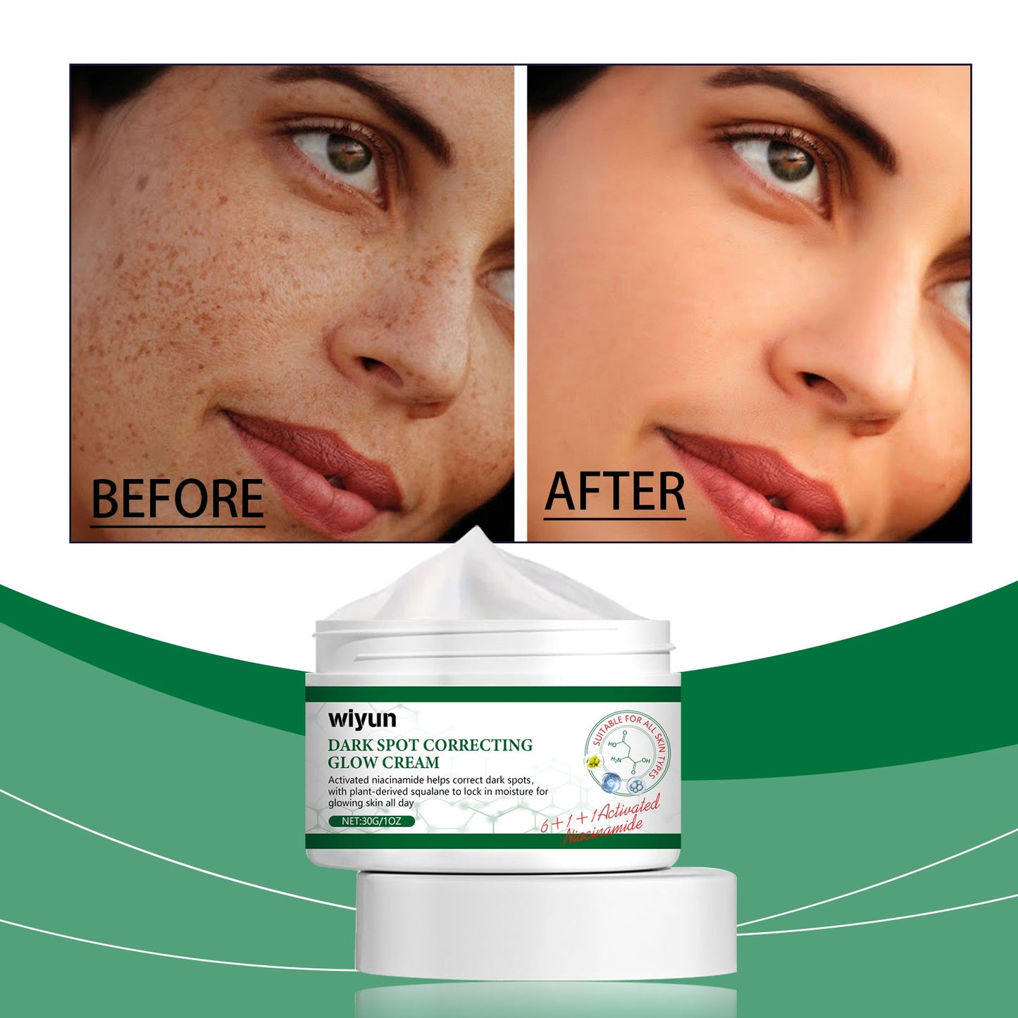 Wiyun Brightening Cream, Restores Dark Skin, Brightening, Moisturizing, Nourishing, Moisturizing, Rejuvenating And Beautifying Face Cream