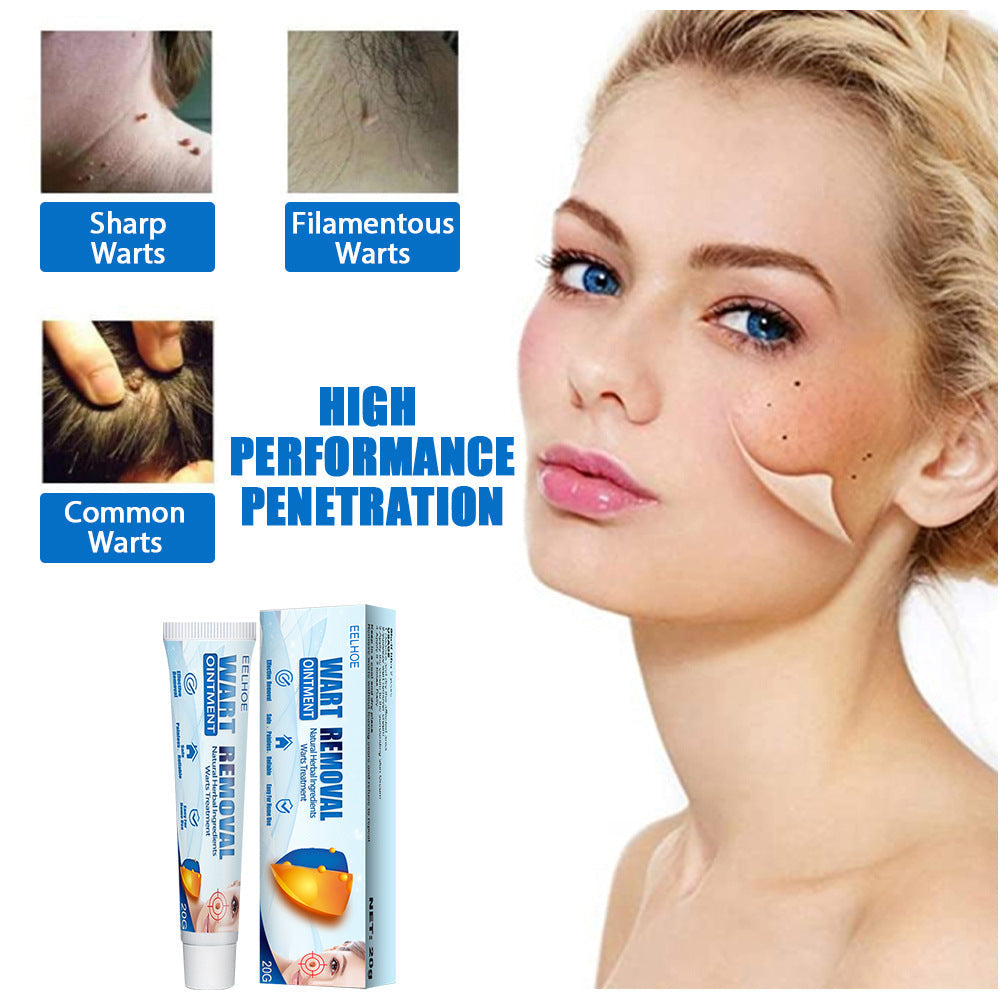Hand And Foot Facial Armpit Flat Monkey Youke Wart Cream