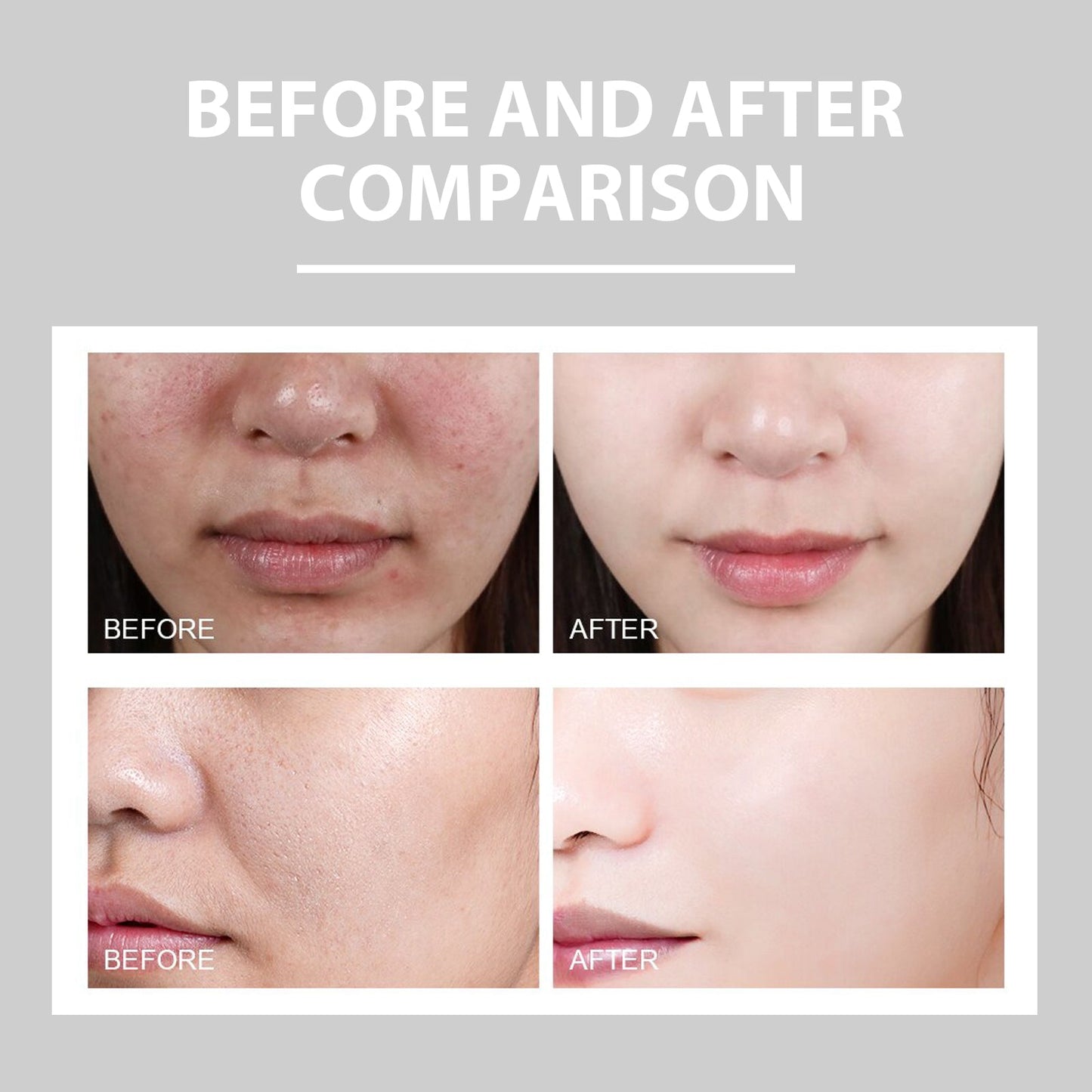 Eelhoe Hydrating Cream Hydrating And Lightening Facial Acne Repair Redness Hydrating And Brightening Moisturizing Cream