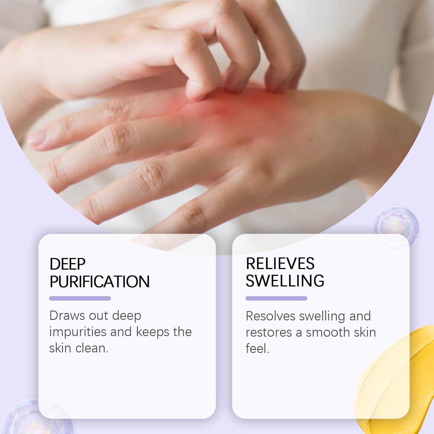 Houkea Propolis Body Care Cream, Nourishes Skin Care For Discomfort Gently Apply Skin Body Care Cream