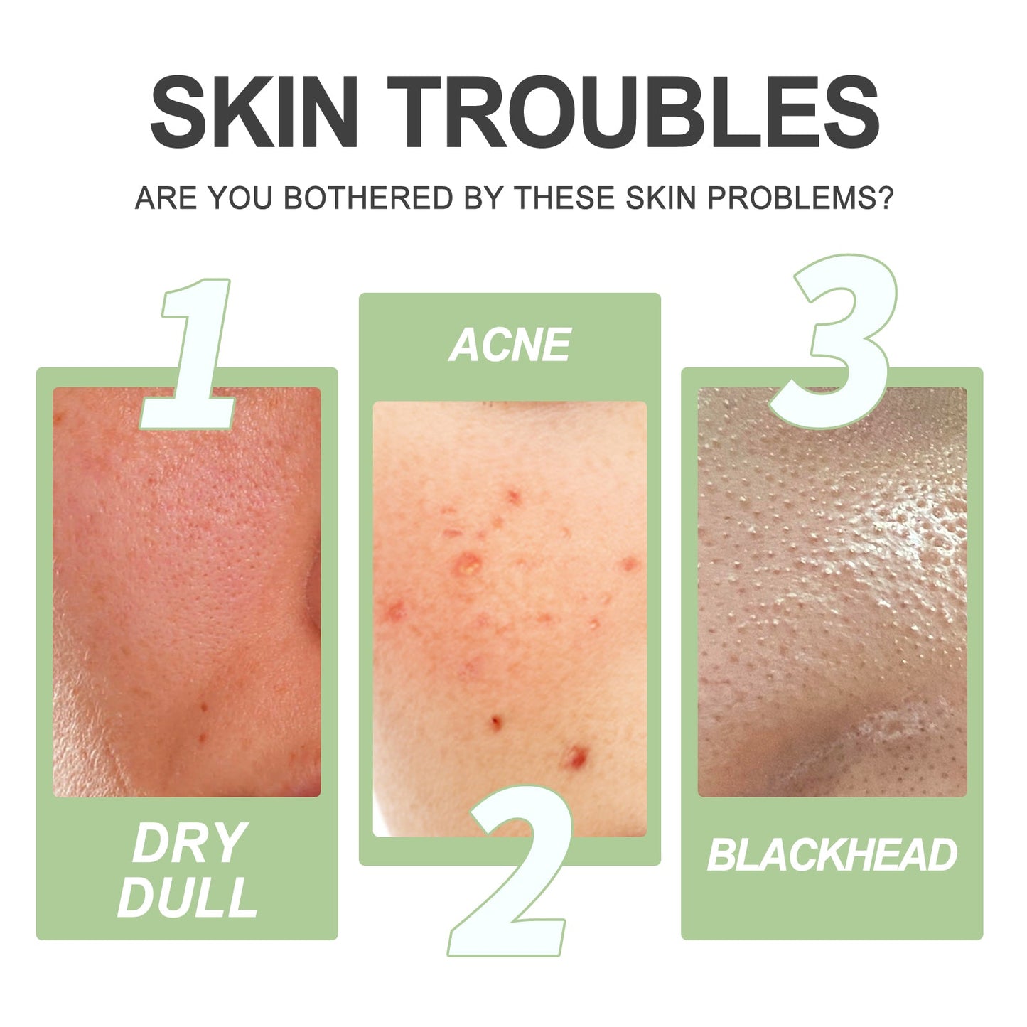 EELHOE Acid Facial Exfoliating Gel Deep Clear Pores Blackheads Acne Whitening Skin Gel