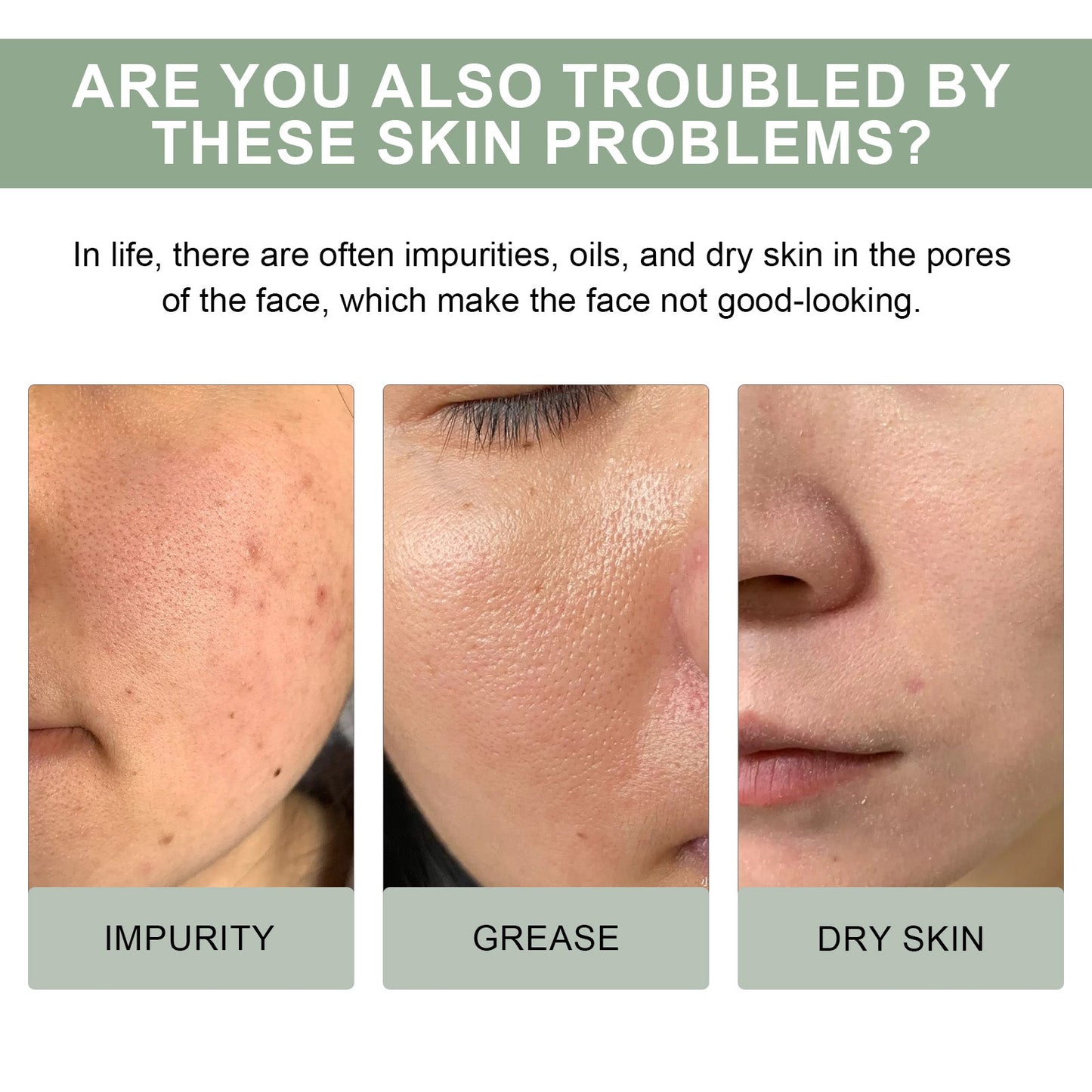 Hoygi Pore Deep Cleansing Foam, Deep Clean Facial Skin Shine Bright Moist Blain To Imprint Clear Water