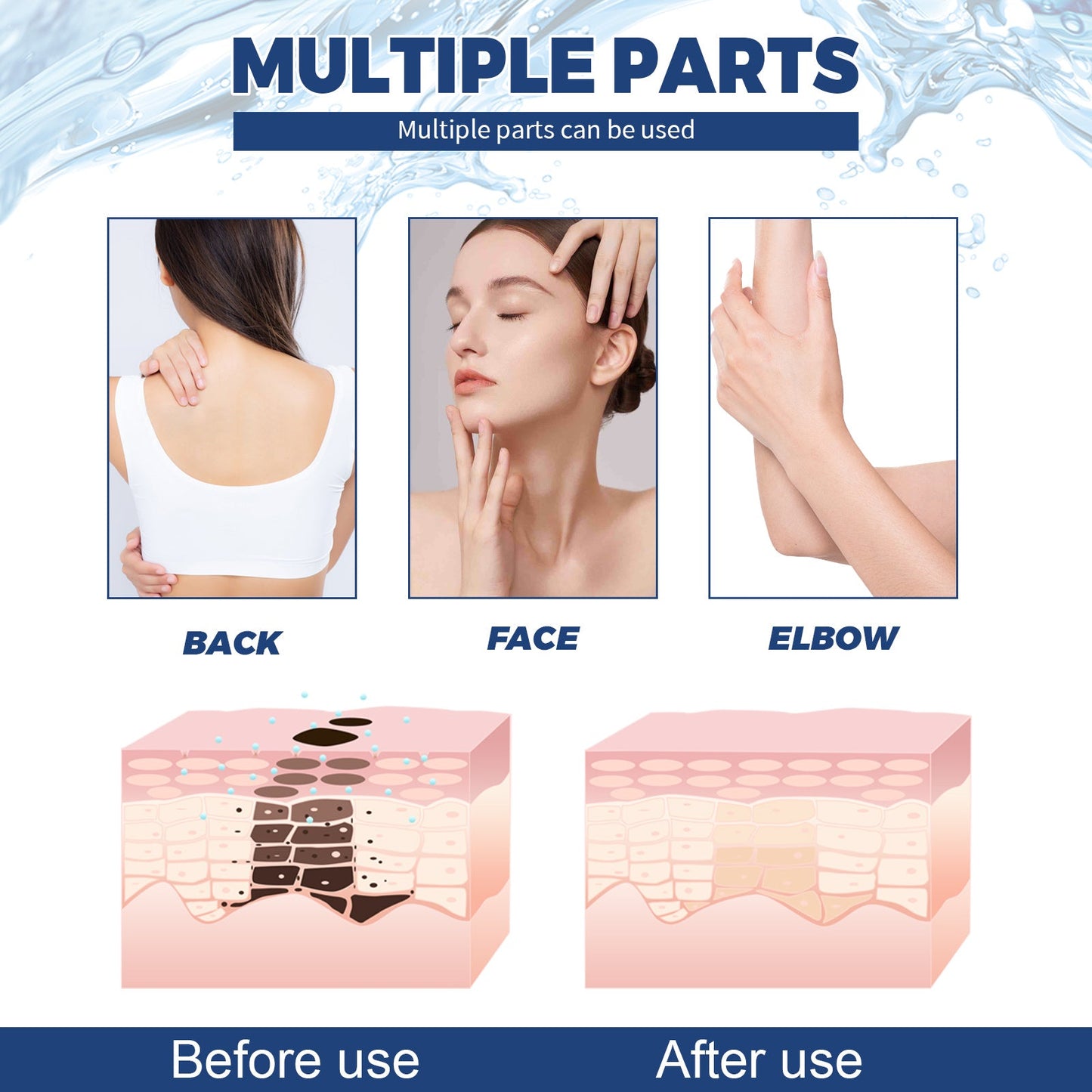 Jaysuing Spot Body Cleanser, Face Body Cleansing Skin Fade Spot Whitening Beauty Skin Cream