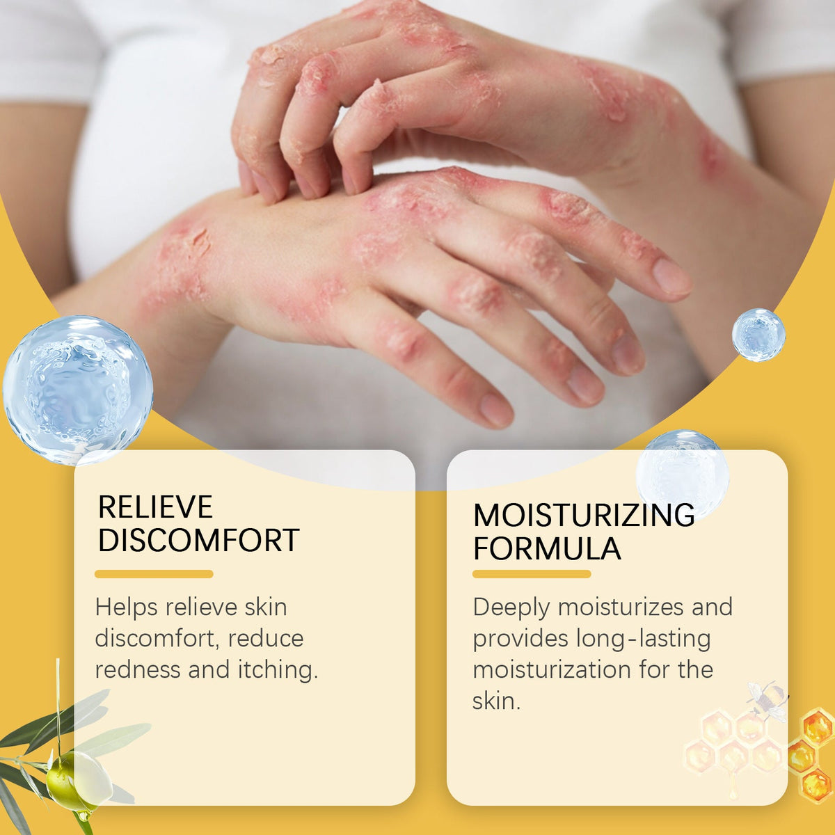 XIMONTH Honey Ultra Soothing Repair Cream, Colloidal Oatmeal Moisturizing Skin Balm For Dry Itchy Irritated Skin, Eczema & Rough Skin Relief Body Care Lotion