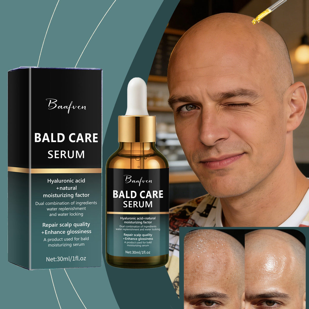 Cross-Border New Model Scalp Care Essence For Men, Moisturizing And Nourishing For Bald Heads And Shaving Skin, 30ml