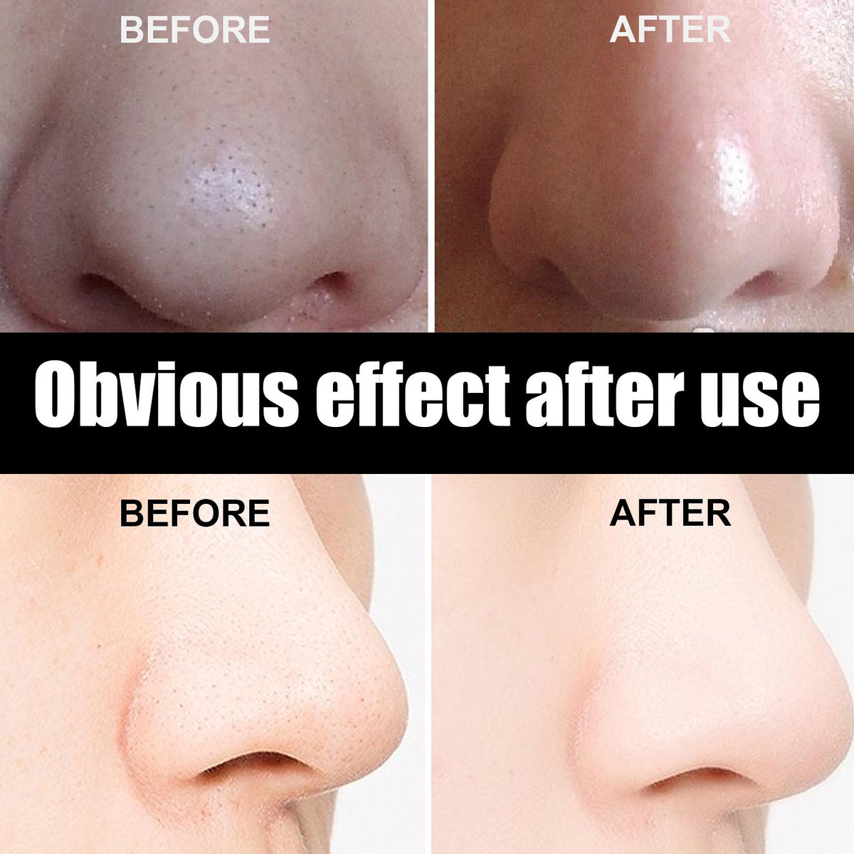 10 Pcs Blackhead Nose Patch Nose Pore Cleansing Strips Deep Cleansing Blackhead Remover Strips For Women Men