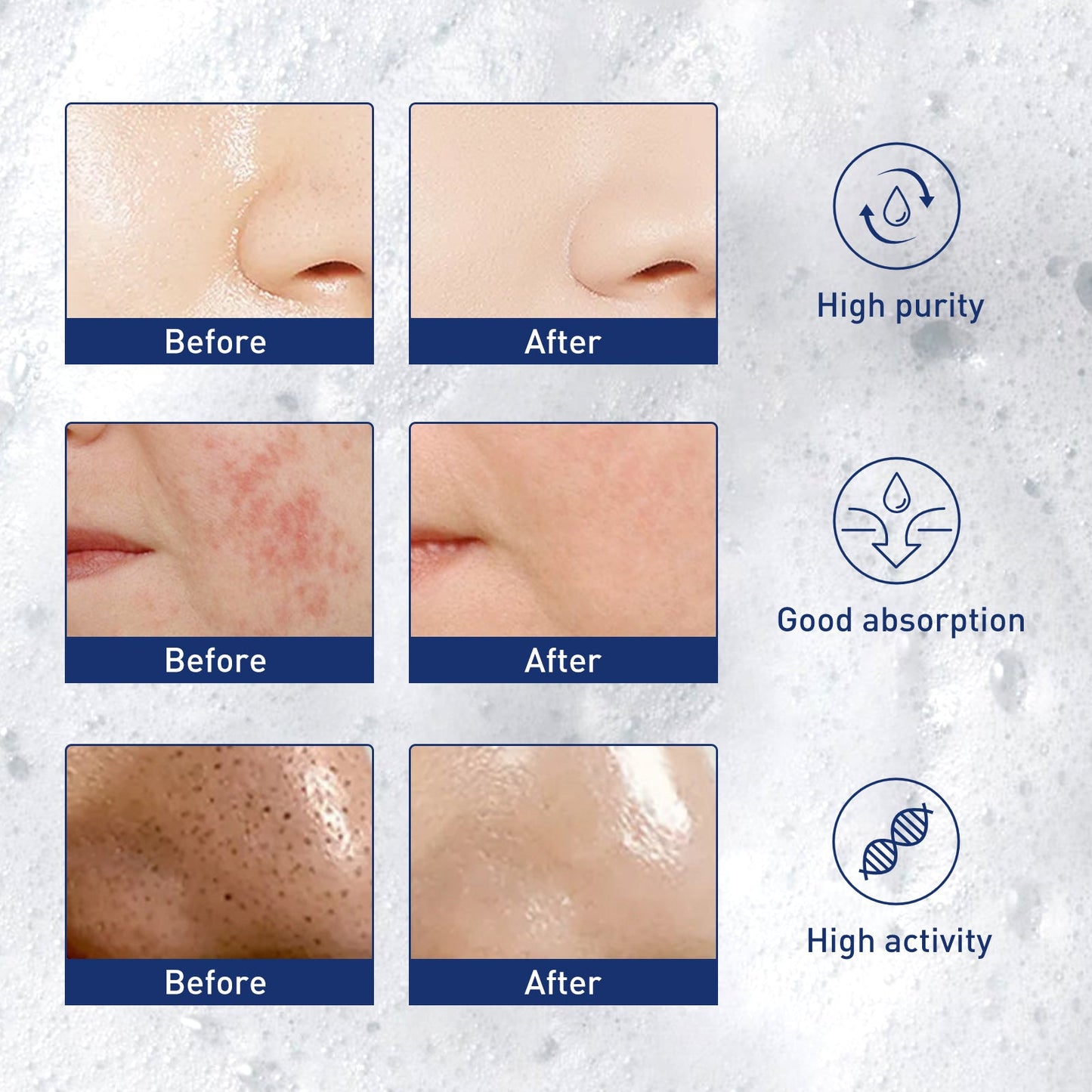 West&Month Exfoliating Mousse, Cleanser Skin Pore Control Oil Gently Cleanses Exfoliating Dead Blackheads