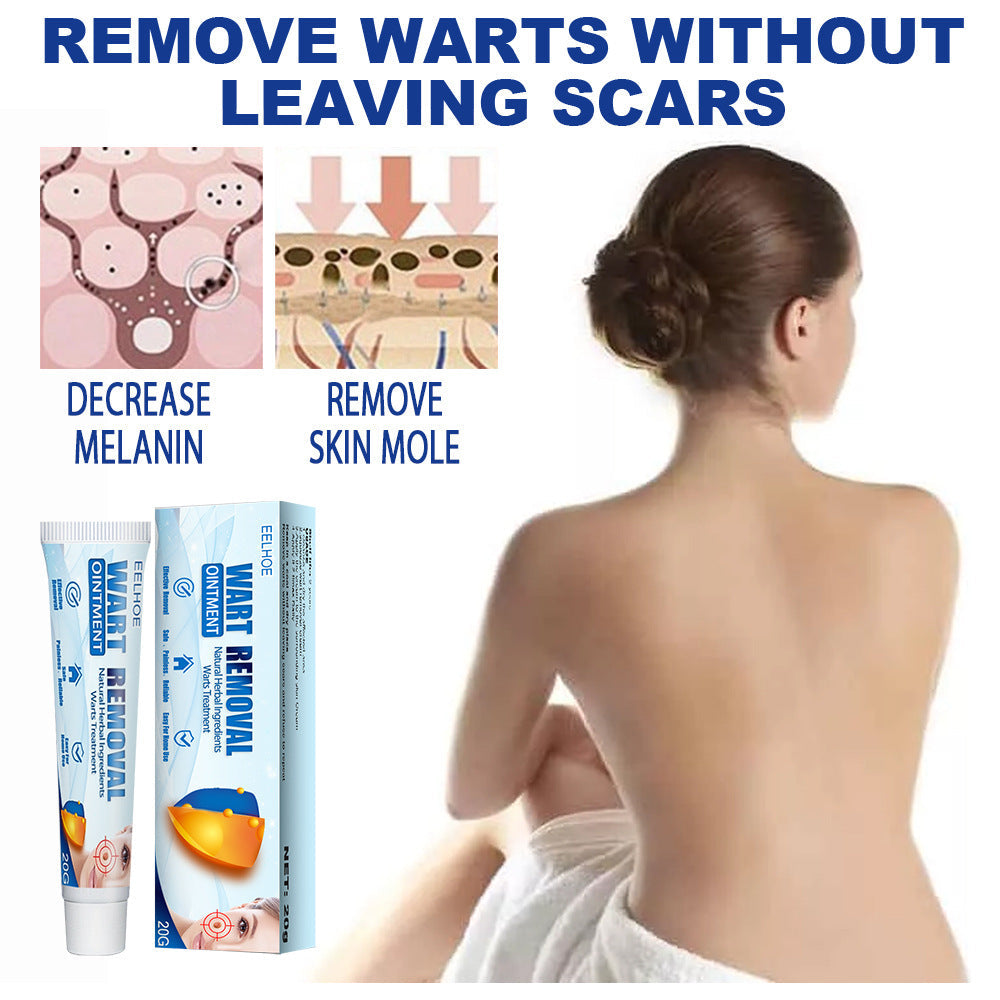 Hand And Foot Facial Armpit Flat Monkey Youke Wart Cream
