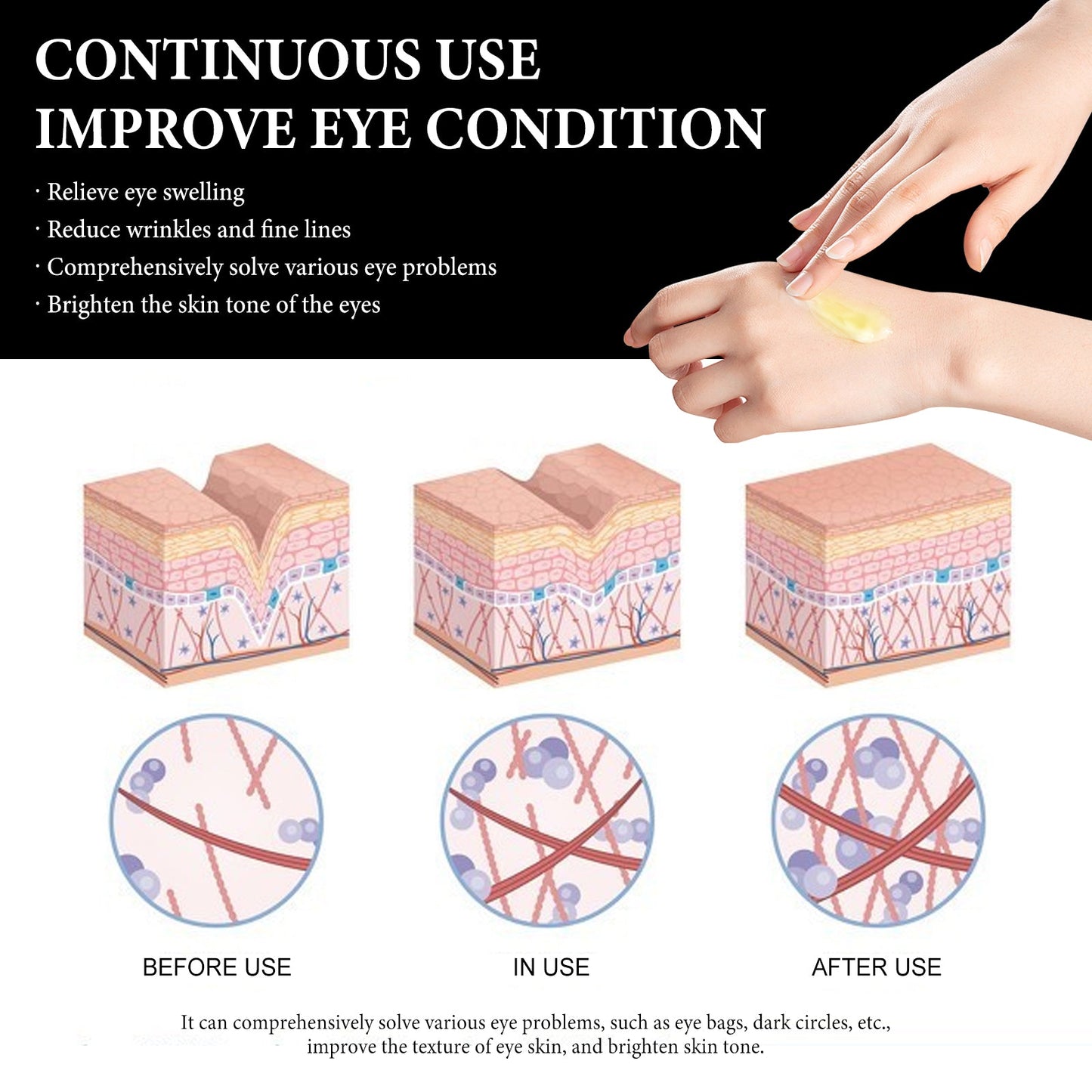 Wiyun Eye Cream: Gentle And Nourishing Care For The Skin Around The Eyes, Soft And Tender Skin Care, Hydrating Skin Care Eye Cream