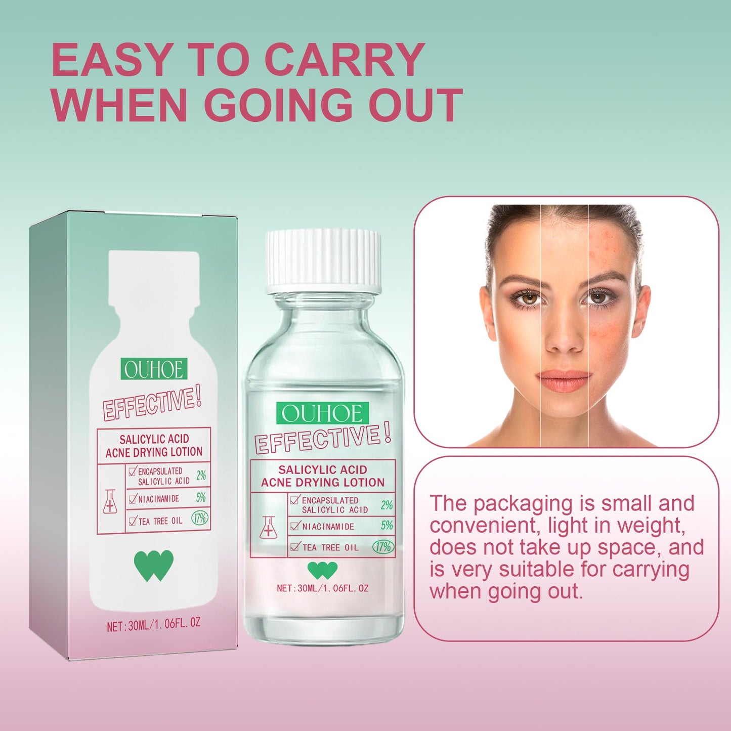 OUHOE Salicylic Acid Acne Lotion Gently Cares For Acne-Prone Skin, Refines Pores And Moisturizes Facial Skin