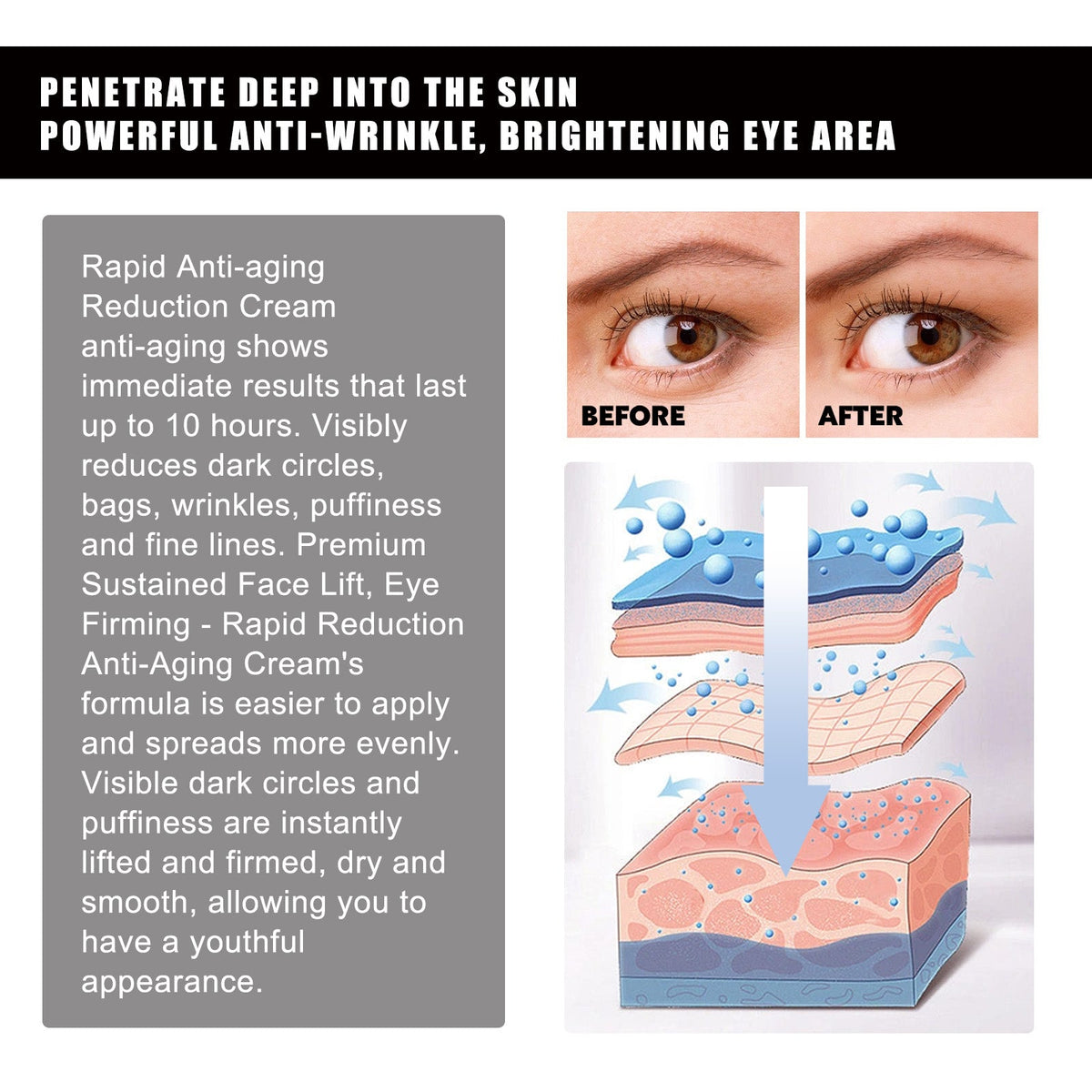 Hoygi Aloe Vera Eye Gel Patch Reduces Fine Lines Under Eyes, Dark Circles Under Eyes, Firming Eyes, Anti-Wrinkle And Moisturizing Eye Patch