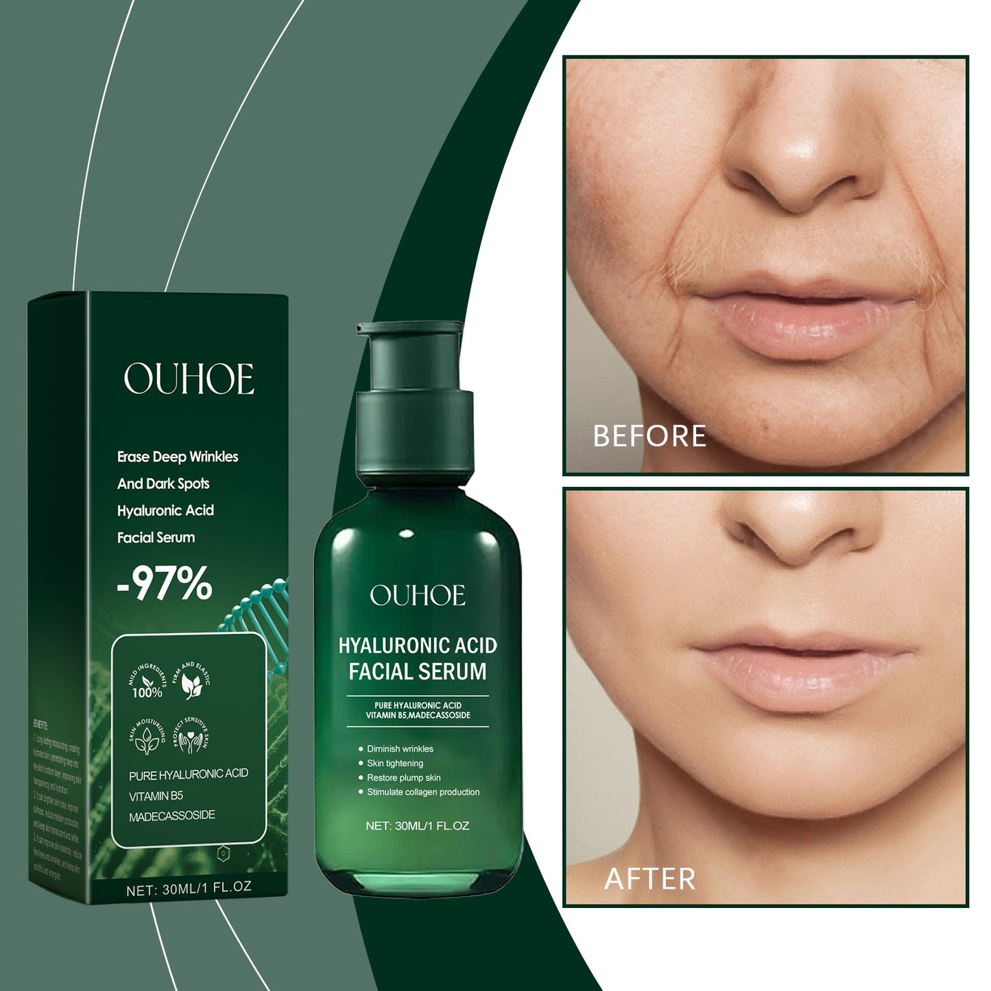 OUHOE  Facial Essence, Moisturizing And Moisturizing Skin Brightening Care Gentle Care Of Facial Skin